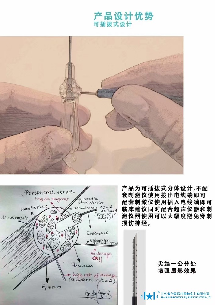 神经丛刺激针治疗方案的综合探讨